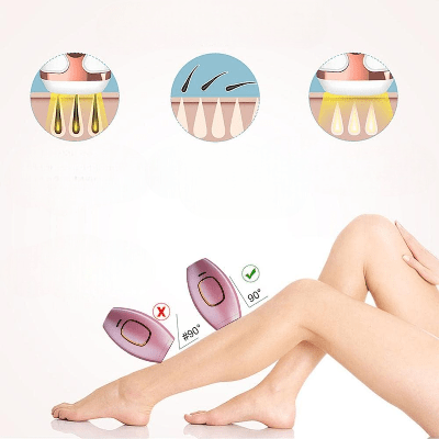 Épilateur Laser - SkinShine™ - Rose - Epilationplus